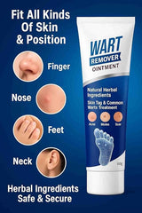 New Wart Remover Ointment cream PACK OF 2